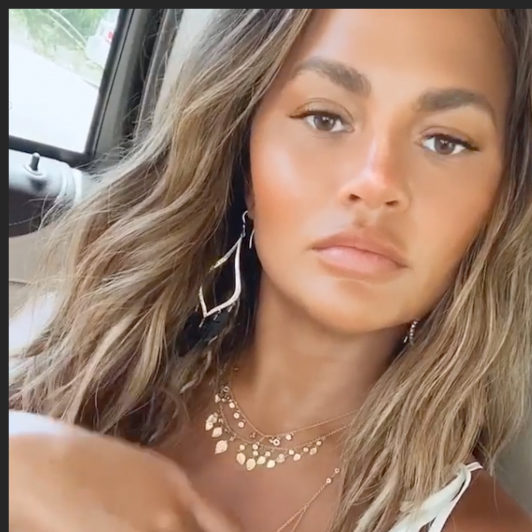 Chrissy Teigen details her recovery from endometriosis surgery